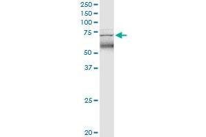TRIM47 monoclonal antibody (M02), clone 3C8.