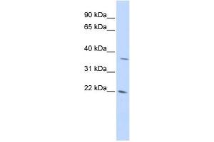 DDIT4L antibody used at 1 ug/ml to detect target protein.