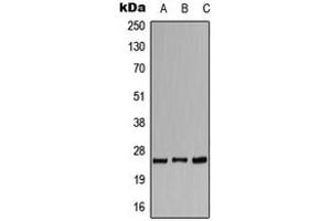 Western blot analysis of CACNG1 expression in HeLa (A), SP2/0 (B), H9C2 (C) whole cell lysates. (CACNG1 anticorps  (Center))
