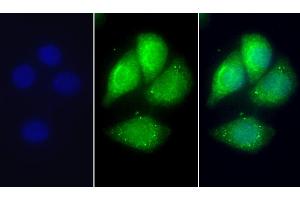 Detection of APOC1 in Human Hela cell using Polyclonal Antibody to Apolipoprotein C1 (APOC1) (APOC1 anticorps  (AA 31-83))