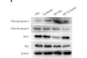 Shank3 overexpression inhibits cardiomyocytes apoptosis. (Caspase 9 anticorps  (AA 1-98))