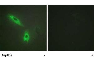 Immunofluorescence analysis of HeLa cells, using LTB polyclonal antibody . (LTB anticorps  (C-Term))