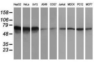 Image no. 2 for anti-5-Aminoimidazole-4-Carboxamide Ribonucleotide Formyltransferase/IMP Cyclohydrolase (ATIC) antibody (ABIN1496505) (ATIC anticorps)