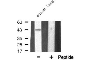 Western blot analysis of TNF Receptor II expression in Mouse lung lysate (TNFRSF1B anticorps  (C-Term))