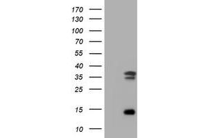 Image no. 2 for anti-Thymidylate Synthetase (TYMS) antibody (ABIN1501593) (TYMS anticorps)