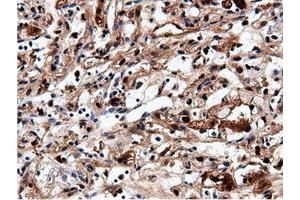 Image no. 14 for anti-5'-Nucleotidase Domain Containing 1 (NT5DC1) antibody (ABIN1499837)