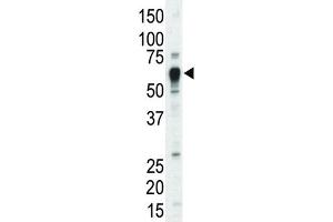 Western Blotting (WB) image for anti-Nuclear Receptor Subfamily 4, Group A, Member 3 (NR4A3) antibody (ABIN3003456)
