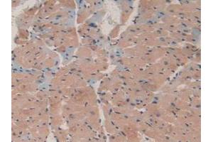 IHC-P analysis of Mouse Heart Tissue, with DAB staining. (MAP1A anticorps  (AA 2552-2759))