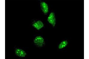 Immunofluorescence of monoclonal antibody to GBX2 on HeLa cell. (GBX2 anticorps  (AA 114-182))