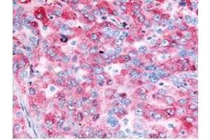 Immunohistochemistry (IHC) image for anti-Epidermal Growth Factor Receptor (EGFR) (C-Term) antibody (ABIN285758) (EGFR anticorps  (C-Term))