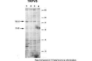 Sample Type: 1-4. (TRPV5 anticorps  (N-Term))