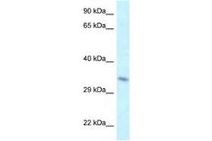 Image no. 1 for anti-TAF8 RNA Polymerase II, TATA Box Binding Protein (TBP)-Associated Factor, 43kDa (TAF8) (AA 109-158) antibody (ABIN6747733) (TAF8 anticorps  (AA 109-158))