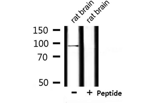 USP16 Antikörper  (N-Term)