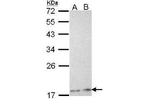 WB Image Sample (30 ug of whole cell lysate) A: H1299 B: Hela 12% SDS PAGE antibody diluted at 1:1000 (PLA2G12A anticorps)