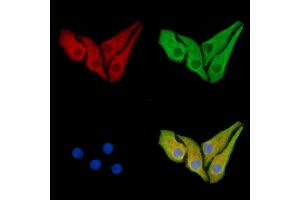 ABIN7095445 and ABIN7099502 staining Hela cells by IF/ICC.