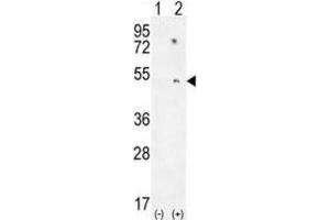 Western Blotting (WB) image for anti-Paraoxonase 1 (PON1) antibody (ABIN2995778) (PON1 anticorps)
