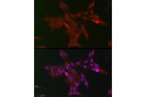 Immunohistochemistry of paraffin-embedded mouse stomach using DC Rabbit pAb (ABIN6132184, ABIN6139432, ABIN6139434 and ABIN6222532) at dilution of 1:150 (40x lens).