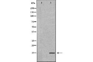 Western blot analysis of extracts of human plasma , using NPPB antibody.