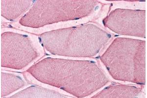 Human Skeletal Muscle: Formalin-Fixed, Paraffin-Embedded (FFPE) (SLC1A5 anticorps  (Internal Region))