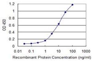 Detection limit for recombinant GST tagged DYX1C1 is 0.