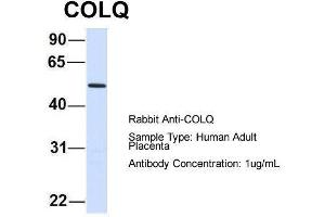 Host:  Rabbit  Target Name:  COLQ  Sample Type:  Human Adult Placenta  Antibody Dilution:  1. (COLQ anticorps  (N-Term))