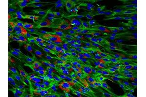 This image was kindly submitted by Preethi Vijayaraj from UCLA, 4% PFA fixed cells, permeabilized with 0.