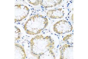 Immunohistochemistry of paraffin-embedded human stomach using PCDHA12 antibody.