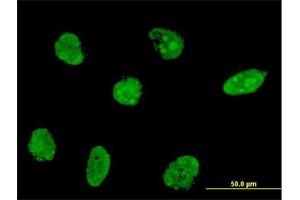 Immunofluorescence of monoclonal antibody to NHLH2 on HeLa cell. (NHLH2 anticorps  (AA 36-135))
