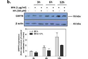 Kaempferol inhibits UPR signaling (a) IMR32 cells were cultured with BFA in presence or absence of kaempferol pre-incubation.
