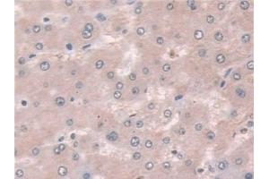 Detection of CXADR in Human Liver Tissue using Polyclonal Antibody to Coxsackie Virus And Adenovirus Receptor (CXADR)