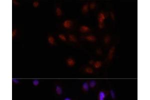 Immunofluorescence analysis of U2OS cells using HOXA2 Polyclonal Antibody at dilution of 1:100. (HOXA2 anticorps)