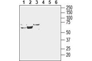 Western blot analysis of rat liver lysate (lanes 1 and 4), mouse liver lysate (lanes 2 and 5) and rat kidney membranes (lanes 3 and 6): - 1-3. (SLC29A3 anticorps  (Intracellular, N-Term))