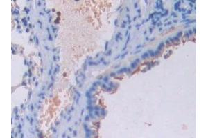 Detection of UCN3 in Mouse Lung Tissue using Polyclonal Antibody to Urocortin 3 (UCN3)