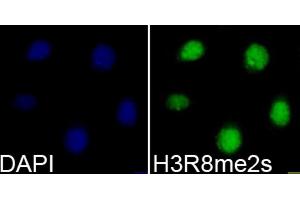 Immunofluorescence analysis of 293T cells using Symmetric DiMethyl-Histone H3-R8 antibody (ABIN3016056, ABIN3016057, ABIN3016058, ABIN1680222 and ABIN6219535). (Histone 3 anticorps  (H3R8me2))