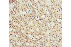 Immunohistochemistry of paraffin-embedded human adrenal gland tissue using ABIN7151117 at dilution of 1:100 (RFFL anticorps  (AA 1-190))