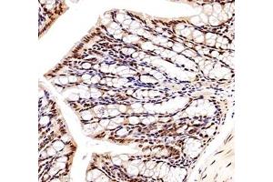 Immunohistochemistry of paraffin embedded mouse colon using ZC3H11A (ABIN7076255) at dilution of 1: 6000 (300x lens)