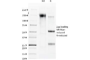 SDS-PAGE Analysis Purified Connexin 32 Mouse Monoclonal Antibody (R5. (GJB1 anticorps)