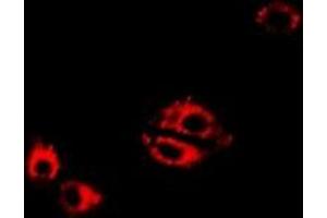 Immunofluorescent analysis of LTA4H staining in Hela cells. (LTA4H anticorps)