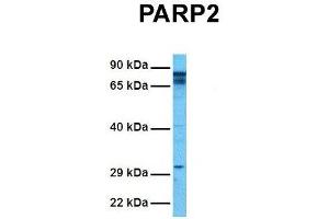 Host:  Rabbit  Target Name:  P Sample Tissue:  Human Hela  Antibody Dilution:  1. (PARP2 anticorps  (Middle Region))