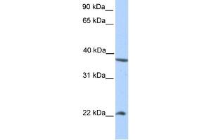 WB Suggested Anti-NEK7 Antibody Titration:  0. (NEK7 anticorps  (N-Term))