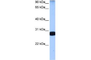 WB Suggested Anti-STAU1 Antibody Titration:  0.