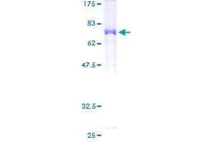 Image no. 1 for Chromosome 17 Open Reading Frame 75 (C17orf75) (AA 1-396) protein (GST tag) (ABIN1347233)