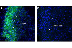 Expression of Sigma-1 Receptor in rat spinal cord. (SIGMAR1 anticorps  (Intracellular))
