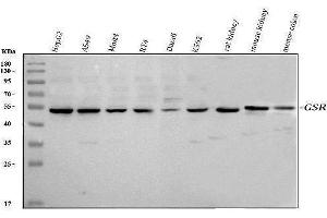 Western blot analysis of Glutathione Reductase using anti-Glutathione Reductase antibody (ABIN5693151). (Glutathione Reductase anticorps  (AA 256-522))