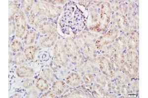 Paraformaldehyde-fixed, paraffin embedded rat kidney tissue, Antigen retrieval by boiling in sodium citrate buffer(pH6) for 15min, Block endogenous peroxidase by 3% hydrogen peroxide for 30 minutes, Blocking buffer (normal goat serum) at 37°C for 20min, Antibody incubation with Rabbit Anti-FCAR Polyclonal Antibody, Unconjugated  at 1:500 overnight at 4°C, followed by a conjugated secondary and DAB staining