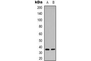 Western blot analysis of Syntaxin 1A (pS14) expression in Hela (A), mouse brain (B) whole cell lysates. (STX1A anticorps  (N-Term, pSer14))
