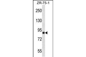 Western blot analysis in ZR-75-1 cell line lysates (35ug/lane). (LRRN4 anticorps  (C-Term))