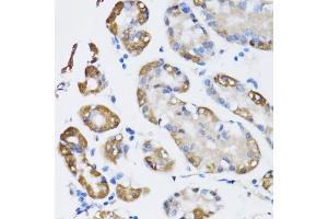 Immunohistochemistry of paraffin-embedded human stomach using N antibody (ABIN6129932, ABIN6144318, ABIN6144319 and ABIN6222781) at dilution of 1:100 (40x lens).