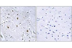 Immunohistochemistry (IHC) image for anti-Insulin Receptor Substrate 1 (IRS1) (AA 605-654) antibody (ABIN2889012) (IRS1 anticorps  (AA 605-654))