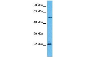 Host:  Rabbit  Target Name:  PNPLA3  Sample Tissue:  Human Hela Whole Cell  Antibody Dilution:  1ug/ml